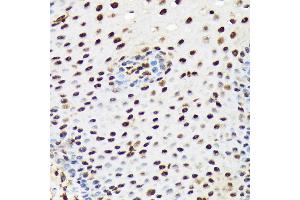 Immunohistochemistry of paraffin-embedded human esophageal using PRP19 Rabbit mAb (ABIN7269505) at dilution of 1:100 (40x lens). (PRP19 antibody)