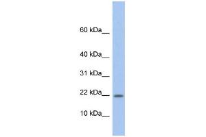 WB Suggested Anti-NDP Antibody Titration: 0. (Norrie Disease (Pseudoglioma) antibody  (Middle Region))