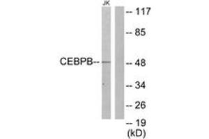 Western blot analysis of extracts from Jurkat cells, using CEBPB Antibody. (CEBPB antibody  (AA 231-280))