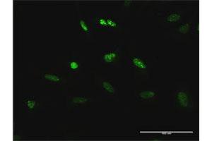 Immunofluorescence (IF) image for anti-Transcription Elongation Factor B (SIII), Polypeptide 3 (110kDa, Elongin A) (TCEB3) (AA 1-772) antibody (ABIN520751)