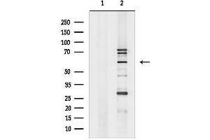 anti-Ets Variant 1 (ETV1) (N-Term) antibody