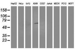 Image no. 2 for anti-Aldehyde Dehydrogenase 3 Family, Member A2 (ALDH3A2) antibody (ABIN1496596) (ALDH3A2 antibody)
