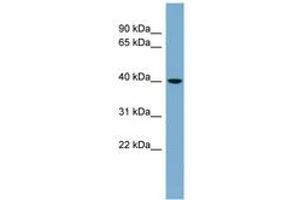 Image no. 1 for anti-Vacuolar Protein Sorting 37C (VPS37C) (AA 35-84) antibody (ABIN6742098) (VPS37C antibody  (AA 35-84))