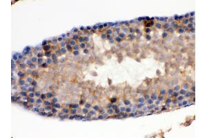 Immunohistochemistry (Paraffin-embedded Sections) (IHC (p)) image for anti-Isocitrate Dehydrogenase 1 (NADP+), Soluble (IDH1) (AA 381-413), (C-Term) antibody (ABIN3043855)