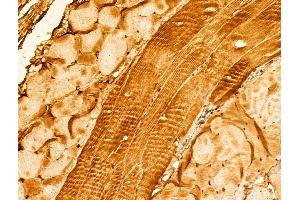 ABIN6265395 and ABIN6273017 at 1/100 staining Mouse skin tissue by IHC-P. (SYNPO antibody  (Internal Region))