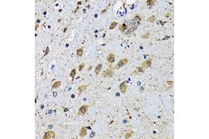 Immunohistochemistry of paraffin-embedded mouse brain using SLC23A2 antibody (ABIN5974077) at dilution of 1/100 (40x lens). (SLC23A2 antibody)