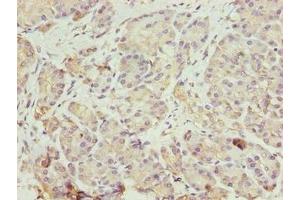 Immunohistochemistry of paraffin-embedded human pancreatic tissue using ABIN7152004 at dilution of 1:100 (ERO1LB antibody  (AA 101-400))