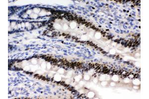 Immunohistochemistry (IHC) image for anti-Protein Kinase, AMP-Activated, beta 2 Non-Catalytic Subunit (PRKAB2) (AA 56-89), (N-Term) antibody (ABIN3043907)