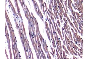 Detection of NPPA in Rat Heart Tissue using Polyclonal Antibody to Natriuretic Peptide Precursor A (NPPA) (NPPA antibody  (AA 25-152))