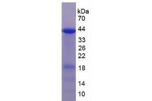 SDS-PAGE analysis of Human UBE3A Protein. (ube3a Protein)