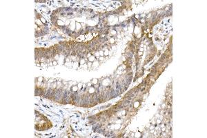 Immunohistochemistry of paraffin-embedded human colon carcinoma using UFM1 Rabbit mAb (ABIN7271183) at dilution of 1:50 (40x lens). (UFM1 antibody)