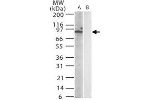 Western blot analysis of mouse Trl12 in (A) transfected and (B) untransfected cell lysate using Trl12 monoclonal antibody, clone 15F1215  at 1:1000. (TLR12 antibody  (AA 791-806))
