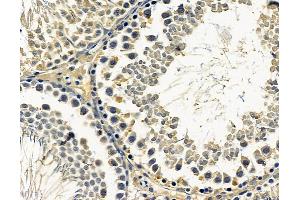 ABIN7096615 and ABIN7100679 at 1/100 staining rat testis tissue by IHC-P. (ARMC9 antibody)
