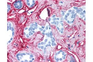 Anti-Collagen VI antibody IHC of human breast. (COL6 antibody)