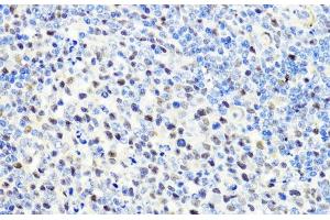 Immunohistochemistry of paraffin-embedded Rat spleen using CTCF Polyclonal Antibody at dilution of 1:100 (40x lens). (CTCF antibody)