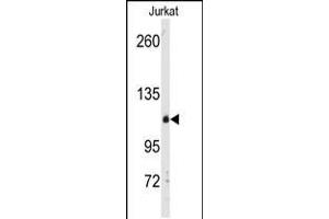 Western blot analysis of anti-anti-DGK delta Pab in Jurkat cell line lysates (35ug/lane) (DGKD antibody  (C-Term))