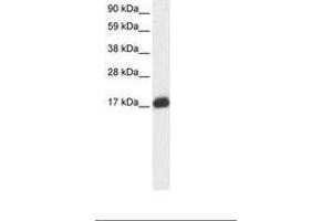 Image no. 2 for anti-E2F Transcription Factor 6 (E2F6) (AA 43-92) antibody (ABIN6735865)