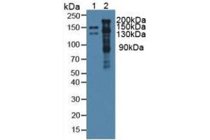 Western blot analysis of (1) Mouse Serum and (2) Mouse Heart Tissue. (Thrombospondin 1 antibody  (AA 515-671))
