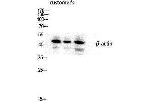 Western Blot (WB) analysis of lysis using Actin beta antibody. (beta Actin antibody  (N-Term))