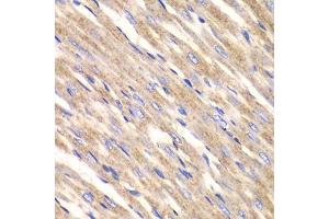 IHC analysis of HeLa cells using SLC25A4 antibody at dilution of 1:100 (40x lens).