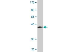 Western Blot detection against Immunogen (37. (MAGEB6 antibody  (AA 135-244))