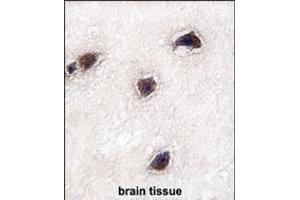Formalin-fixed and paraffin-embedded human brain tissue reacted with CABP1 antibody (C-term) (ABIN391850 and ABIN2841684) , which was peroxidase-conjugated to the secondary antibody, followed by DAB staining. (CABP1 antibody  (C-Term))
