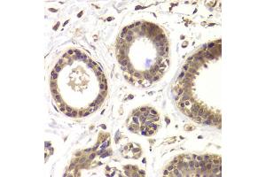 Immunohistochemistry of paraffin-embedded human mammary gland using HDAC5 antibody. (HDAC5 antibody)