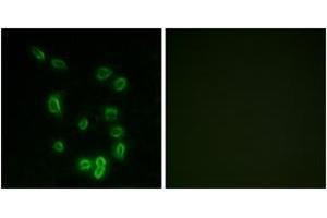 Immunofluorescence analysis of HepG2 cells, using DARPP-32 (Phospho-Thr34) Antibody. (DARPP32 antibody  (pThr34))