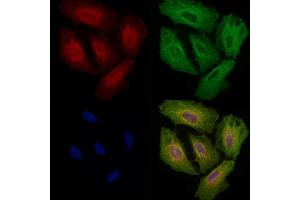 ABIN6257331 and ABIN6275242 staining  cells by IF/ICC. (MRPL3 antibody  (N-Term))
