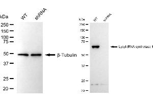 Western blotting analysis using lysyl-tRNA synthetase 1 antibody (ABIN7800951). (Recombinant Lysyl-tRNA Synthetase 1 antibody)