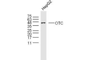Human HepG2 cells probed with OTC Polyclonal Antibody, unconjugated  at 1:300 overnight at 4°C followed by a conjugated secondary antibody at 1:10000 for 90 minutes at 37°C. (OTC antibody  (AA 51-150))