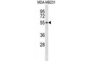 Western Blotting (WB) image for anti-Pepsinogen 3, Group I (Pepsinogen A) (PGA3) antibody (ABIN2995164)