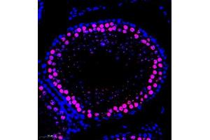 Immunofluorescence of paraffin embedded rat testis using SCP1 (ABIN7075786) at dilution of 1:500 (300x lens) (SYCP1 antibody)