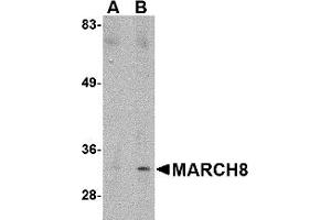 Western Blotting (WB) image for anti-Membrane-Associated Ring Finger (C3HC4) 8, E3 Ubiquitin Protein Ligase (MARCH8) (C-Term) antibody (ABIN1030506) (MARCH8 antibody  (C-Term))