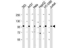 Western Blot at 1:2000 dilution Lane 1: 293 whole cell lysate Lane 2: A431 whole cell lysate Lane 3: Hela whole cell lysate Lane 4: HepG2 whole cell lysate Lane 5: HT-1080 whole cell lysate Lane 6: Jurkat whole cell lysate Lysates/proteins at 20 ug per lane. (DDX21 antibody  (N-Term))