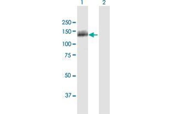 OSBPL5 antibody  (AA 1-879)
