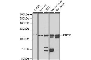 Western blot analysis of extracts of various cell lines, using PTPN3 antibody (ABIN6132535, ABIN6146448, ABIN6146449 and ABIN6222030) at 1:1000 dilution. (PTPN3 antibody  (AA 1-300))