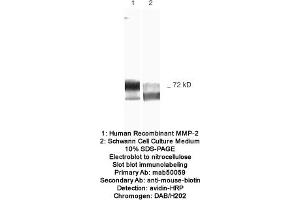 Image no. 1 for anti-Matrix Metalloproteinase 2 (MMP2) antibody (ABIN363213) (MMP2 antibody)
