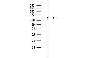 anti-Tripartite Motif-containing 4 (TRIM4) antibody