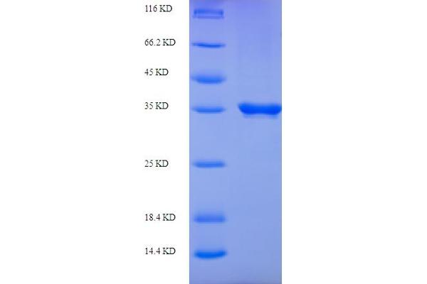 CTU2 Protein (AA 20-196) (His-SUMO Tag)