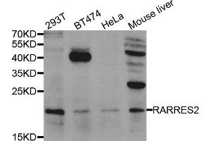 Western blot analysis of extracts of various cell lines, using RARRES2 antibody. (Chemerin antibody)