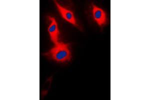Immunofluorescent analysis of ACRBP staining in HeLa cells. (ACRBP antibody  (Center))