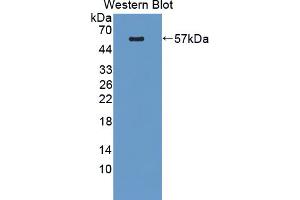 Figure. (PLEKHA1 antibody  (AA 105-351))
