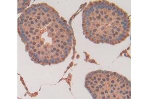 Figure. (HSF2 antibody  (AA 1-200))