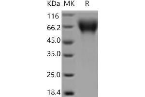 Western Blotting (WB) image for CD6 (CD6) (Active) protein (His tag) (ABIN7194912) (CD6 Protein (CD6) (His tag))