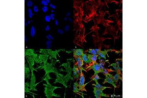 Immunocytochemistry/Immunofluorescence analysis using Mouse Anti-NrCAM Monoclonal Antibody, Clone S364-51 . (NrCAM antibody  (Extracellular Domain) (Atto 594))