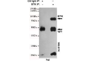 Immunoprecipitation analysis of Raji cell lysates using BTK mouse mAb. (BTK antibody)