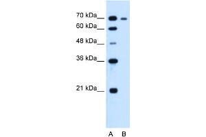 WB Suggested Anti-RRM1 Antibody Titration:  1. (RRM1 antibody  (N-Term))