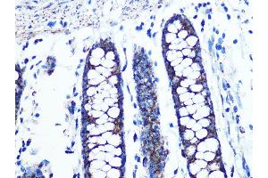 Immunohistochemistry of paraffin-embedded human colon using UQCRC2 Rabbit mAb (ABIN1679334, ABIN3018863, ABIN3018864 and ABIN7101676) at dilution of 1:100 (40x lens). (UQCRC2 antibody)