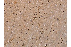 The image is immunohistochemistry of paraffin-embedded Human brain tissue using ABIN7129566(GADD45A Antibody) at dilution 1/30. (GADD45A antibody)